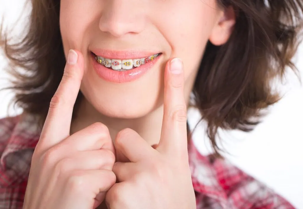 Cost of Braces in Charlottesville, VA